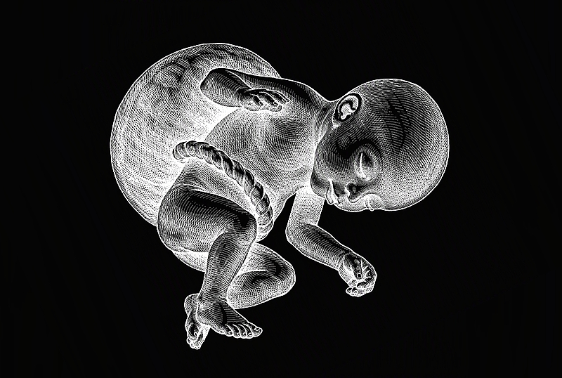1 op de 5 zwangerschappen eindigt in een abortus