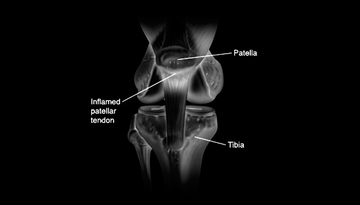Minder maaltijden per dag, sterkere pezen
