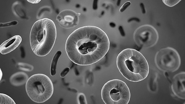 Magazine Voetzorg + | Sepsis herkennen is levens redden